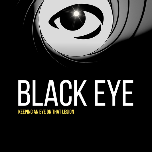 Save 10% On Your First Order of Black Eye™