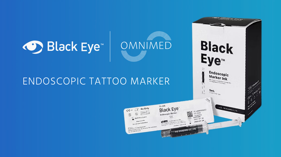 Environmental Highlights of Black Eye